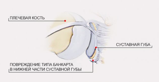 Ортез верхней конечности AM-AO-KG-02 CLEVER 2 ROTATOR